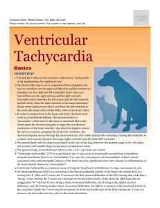 ventricular_tachycardia