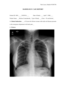 DI-Chest-lung fibrosis