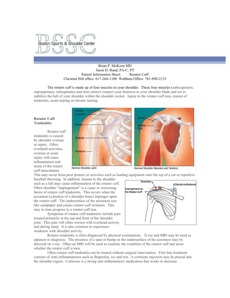 Rotator Cuff Impingement - Boston Sports & Shoulder Center