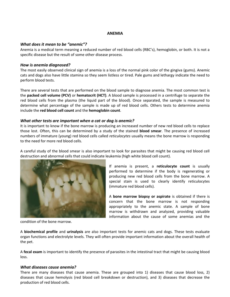 malignant mesothelioma pleural cavities