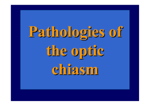 Pathologies of the optic chiasm