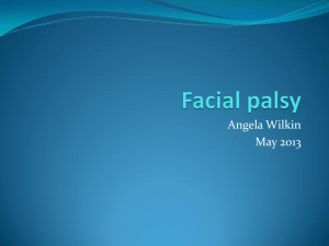 Facial palsy - South Tees Hospitals NHS Trust