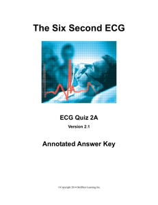 The Six Second ECG