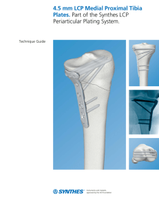 4.5 mm LCP Medial Proximal Tibia Plates Technique Guide