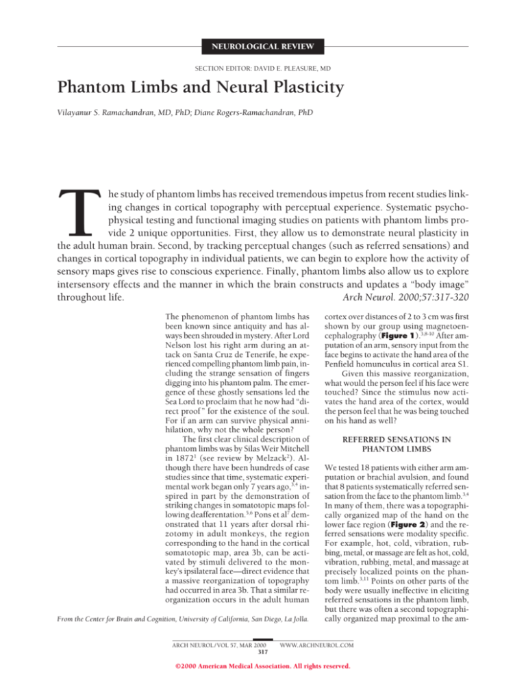 Phantom Limbs And Neural Plasticity