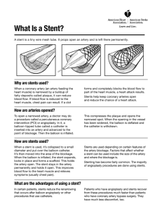 What Is a Stent?