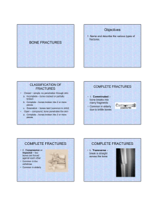 BONE FRACTURES Objectives COMPLETE FRACTURES