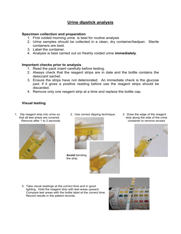 research paper on urine test