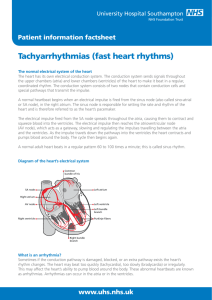 Tachyarrhythmias - patient information