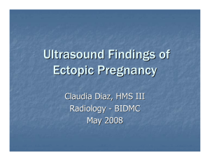 Ultrasound Findings of Ectopic Pregnancy