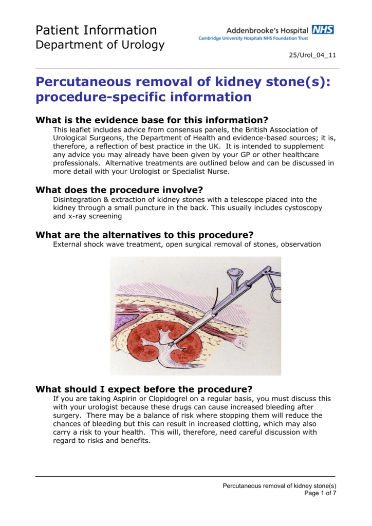 Patient Information Percutaneous Removal Of Kidney Stone S