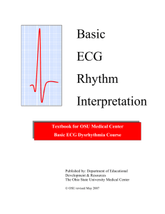 Basic ECG Rhythm Interpretation