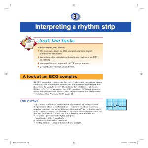 Interpreting a rhythm strip