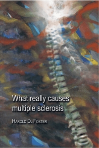What really causes multiple sclerosis