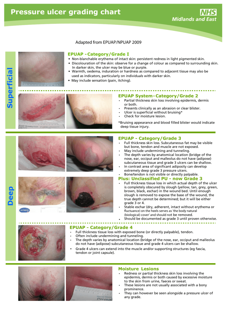 Wound Staging Chart
