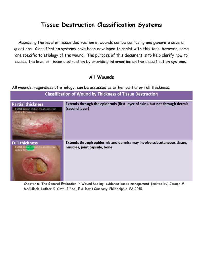 tissue-destruction-classification-systems