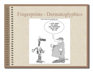 Fingerprints - Dermatoglyphics