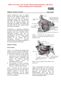 Medial maxillectomy - Vula