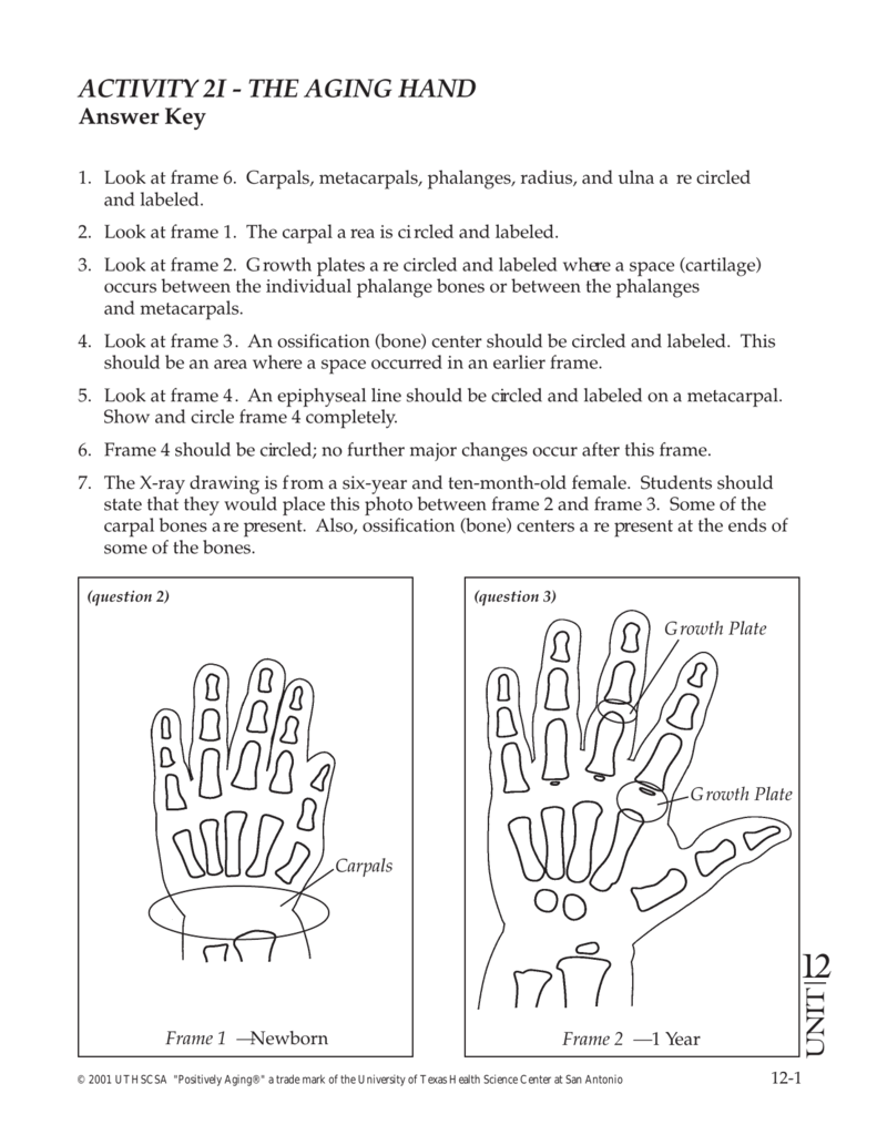 Activity 2i The Aging Hand Answer Key