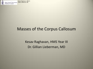 Masses of the Corpus Callosum - Lieberman's eRadiology Learning