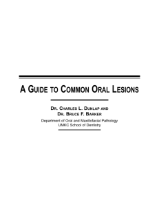 a guide to common oral lesions