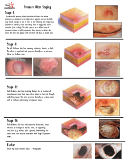 Pressure Ulcers - Patient Safety Federation