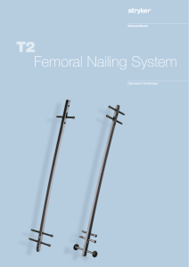 T2 Femoral Nailing System