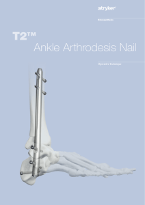 T2 Ankle Arthrodesis Nail Operative Technique