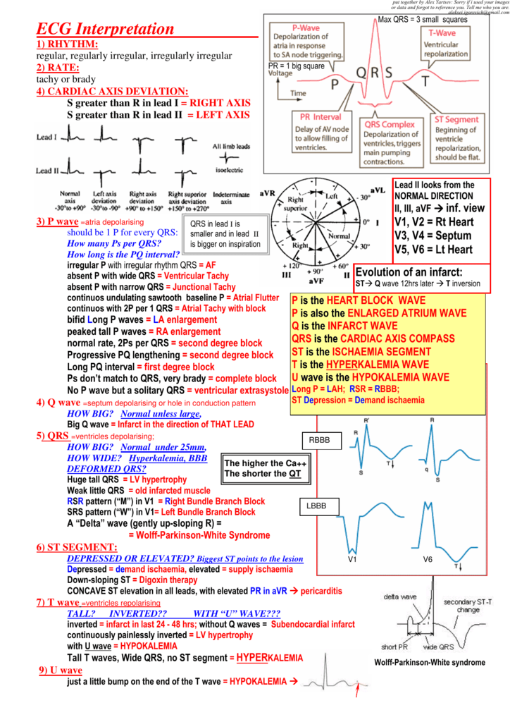 Ekg Interpretation Cheat Sheet Printable