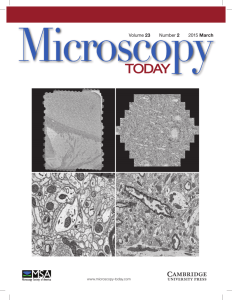 Multiple-Beam Scanning Electron Microscopy