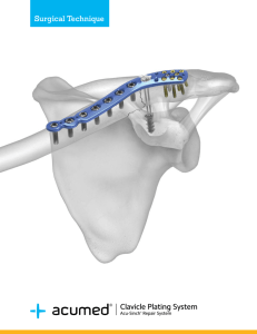 Acumed Clavicle Plating System with Acu