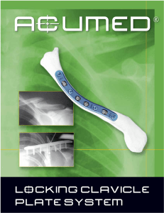 Acumed's Locking Clavicle Plates