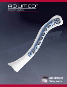 Locking Clavicle Plating System