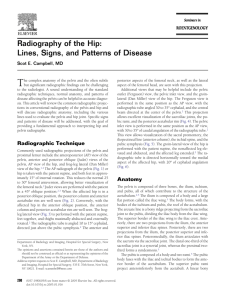 Radiography of the Hip: Lines, Signs, and Patterns of Disease