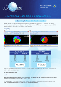 Scleral Lens Case Studies: Keratoconus