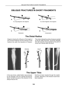 28 OBLIQUE FRACTURES IN SHORT