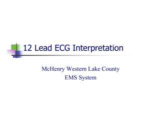 12 Lead ECG Interpretation