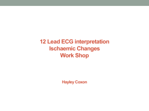 12 Lead ECG Training Module 4