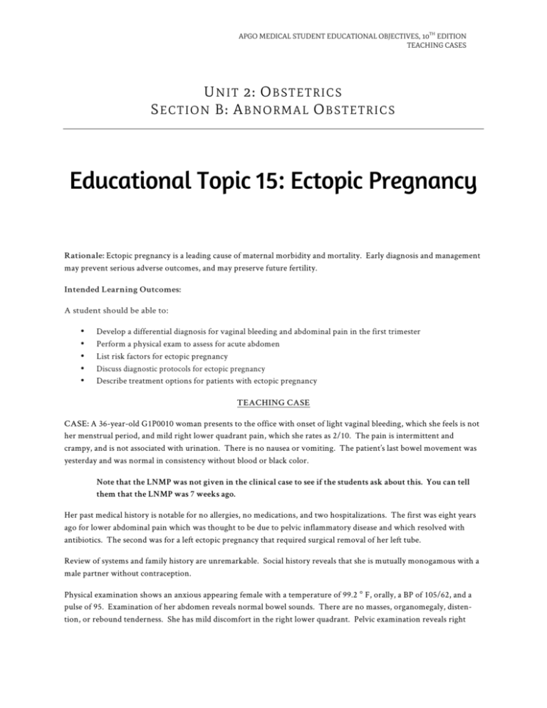educational topic 15 ectopic pregnancy