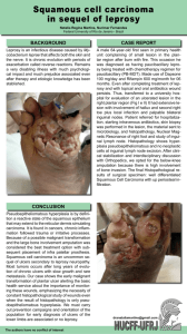 Squamous cell carcinoma in sequel of leprosy
