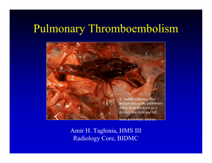 Pulmonary Thromboembolism