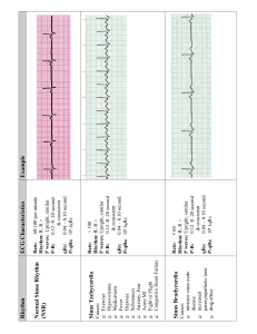 EKG Flash Chart