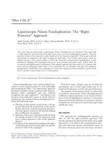 Laparoscopic Nissen Fundoplication: The “Right Posterior” Approach