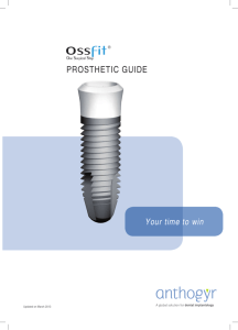 prosthetic guide