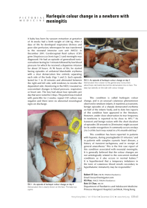 Harlequin colour change in a newborn with meningitis