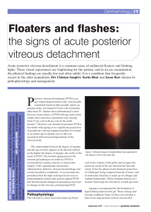 Floaters and flashes: the signs of acute posterior