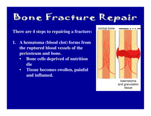 There are 4 steps to repairing a fracture: 1. A hematoma (blood clot