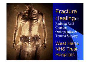 Fracture Healing & Factors - MOTEC LIFE-UK