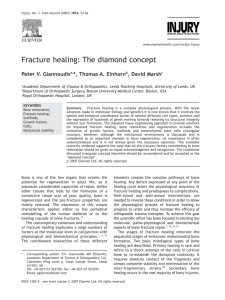 Fracture healing: The diamond concept