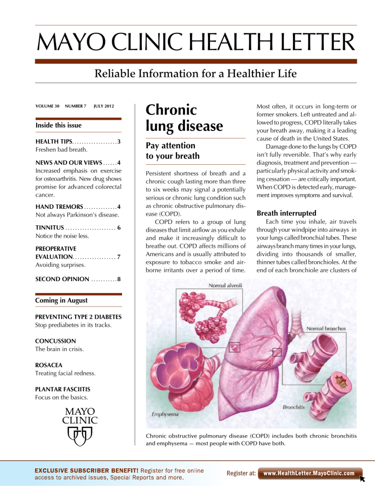 MAYO CLINIC HEALTH LETTER